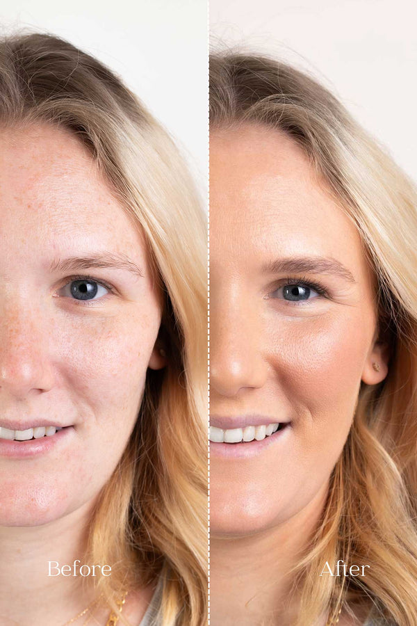 Scoop Whole Beauty model showcases natural liquid cover mineral foundation in shade light in before and after shot - maca